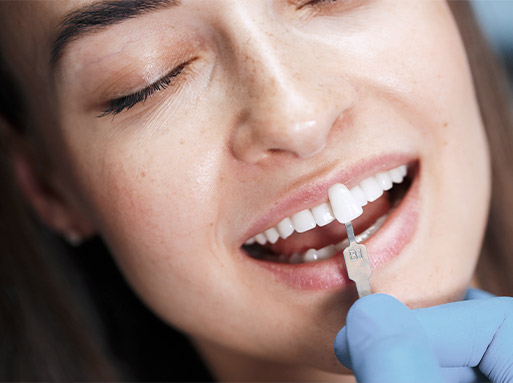 estetica-dental-vera-clinica-dental-madrid